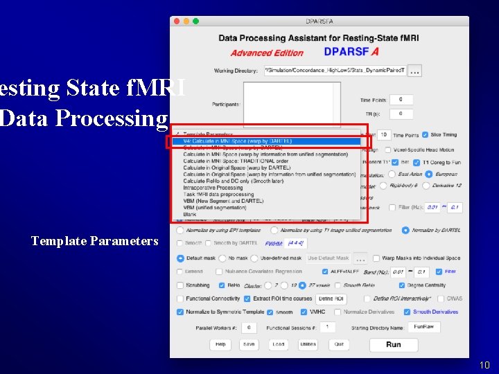 esting State f. MRI Data Processing Template Parameters 10 