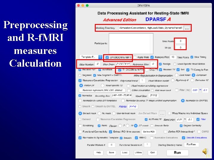 Preprocessing and R-f. MRI measures Calculation 11 