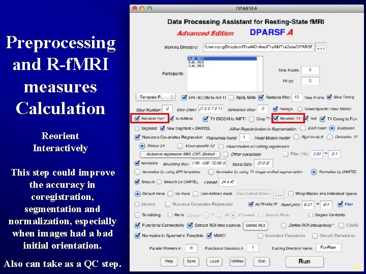 Preprocessing and R-f. MRI measures Calculation Reorient Interactively This step could improve the accuracy