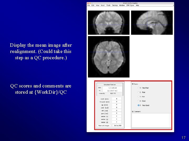 Display the mean image after realignment. (Could take this step as a QC procedure.