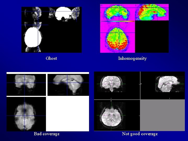 Ghost Bad coverage Inhomogeneity Not good coverage 