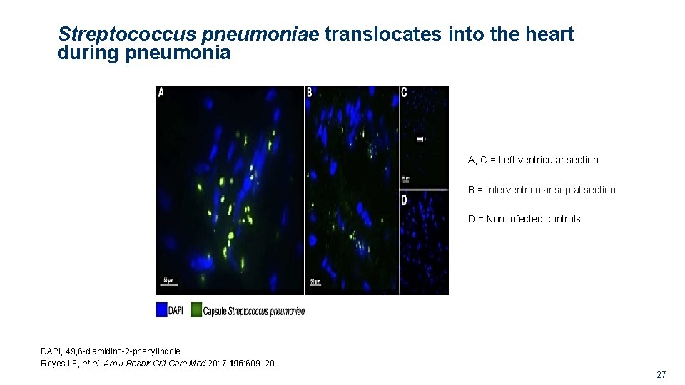 Streptococcus pneumoniae translocates into the heart during pneumonia A, C = Left ventricular section