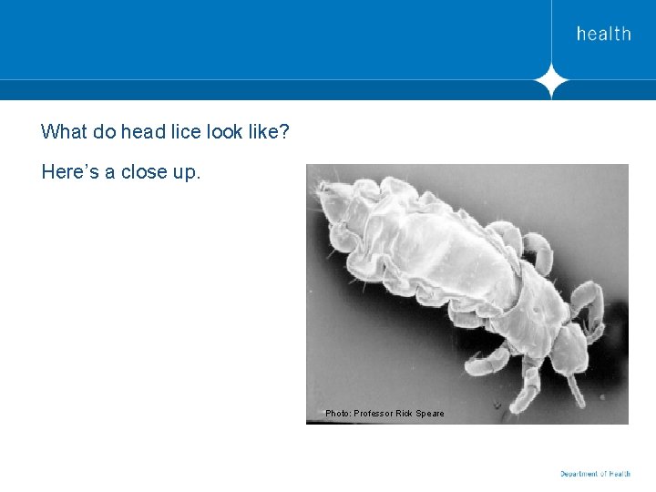 What do head lice look like? Here’s a close up. Photo: Professor Rick Speare