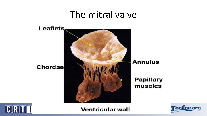 The mitral valve 
