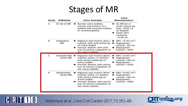 Stages of MR Nishimura et al. J Am Coll Cardiol 2017; 70: 252– 89.