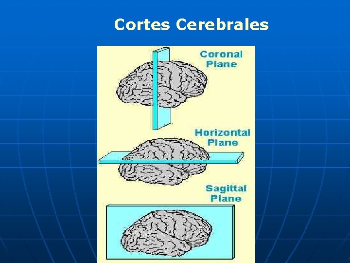 Cortes Cerebrales 