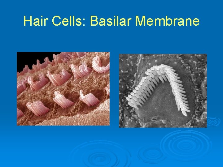 Hair Cells: Basilar Membrane 