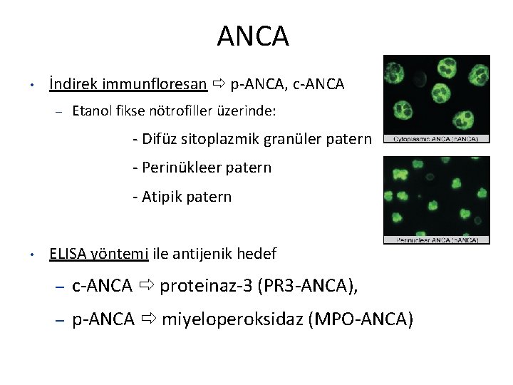 ANCA • İndirek immunfloresan p-ANCA, c-ANCA – Etanol fikse nötrofiller üzerinde: - Difüz sitoplazmik