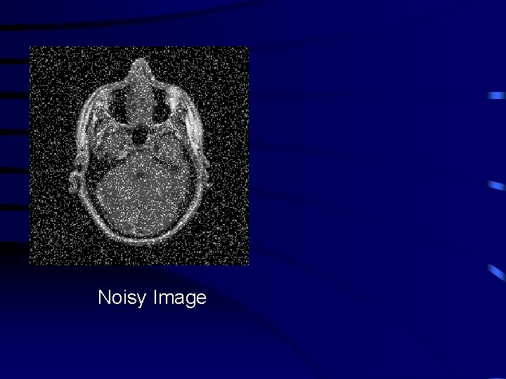 Noisy Image 