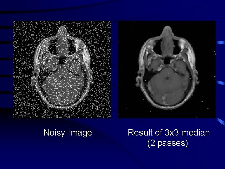 Noisy Image Result of 3 x 3 median (2 passes) 