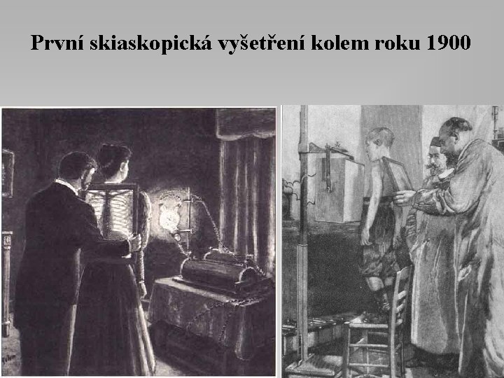 První skiaskopická vyšetření kolem roku 1900 