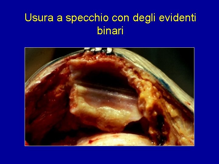 Usura a specchio con degli evidenti binari 