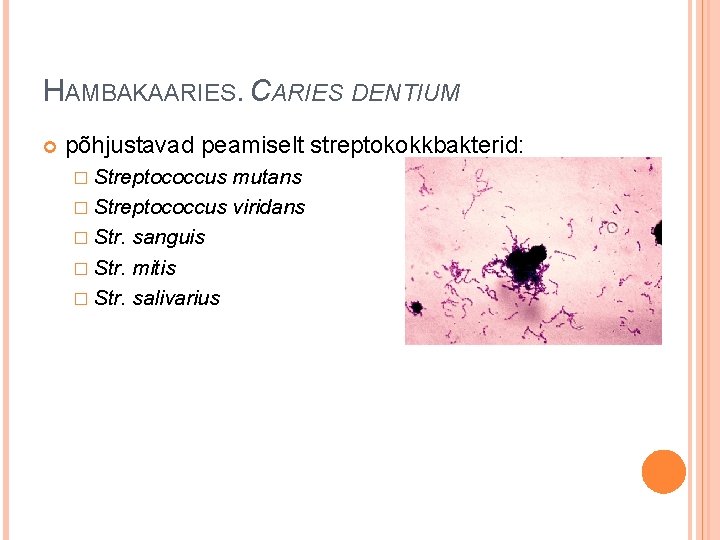 HAMBAKAARIES. CARIES DENTIUM põhjustavad peamiselt streptokokkbakterid: � Streptococcus mutans � Streptococcus viridans � Str.