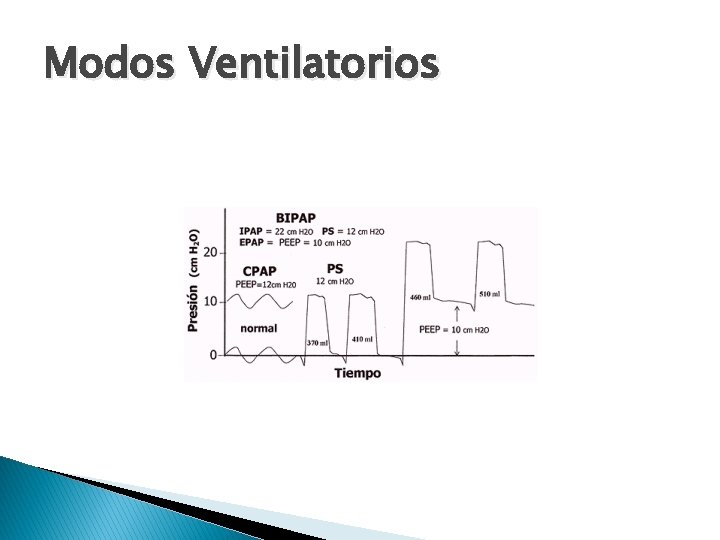 Modos Ventilatorios 
