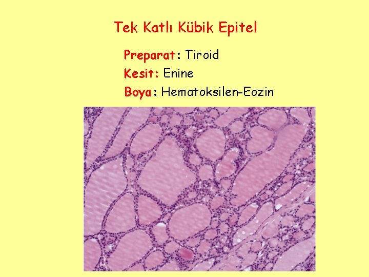 Tek Katlı Kübik Epitel Preparat: Tiroid Kesit: Enine Boya: Hematoksilen-Eozin 