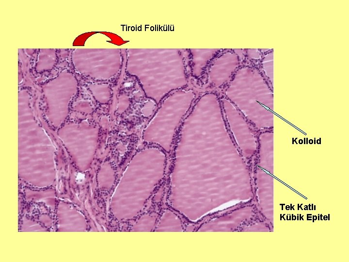 Tiroid Folikülü Kolloid Tek Katlı Kübik Epitel 