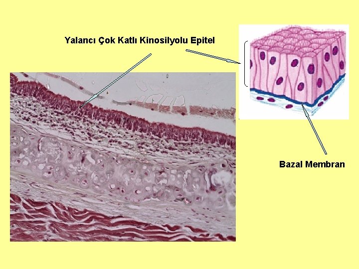 Yalancı Çok Katlı Kinosilyolu Epitel Bazal Membran 