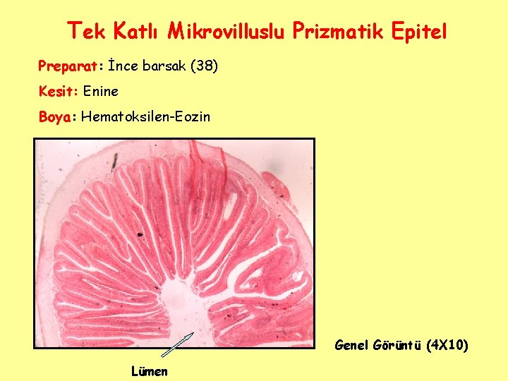 Tek Katlı Mikrovilluslu Prizmatik Epitel Preparat: İnce barsak (38) Kesit: Enine Boya: Hematoksilen-Eozin Genel