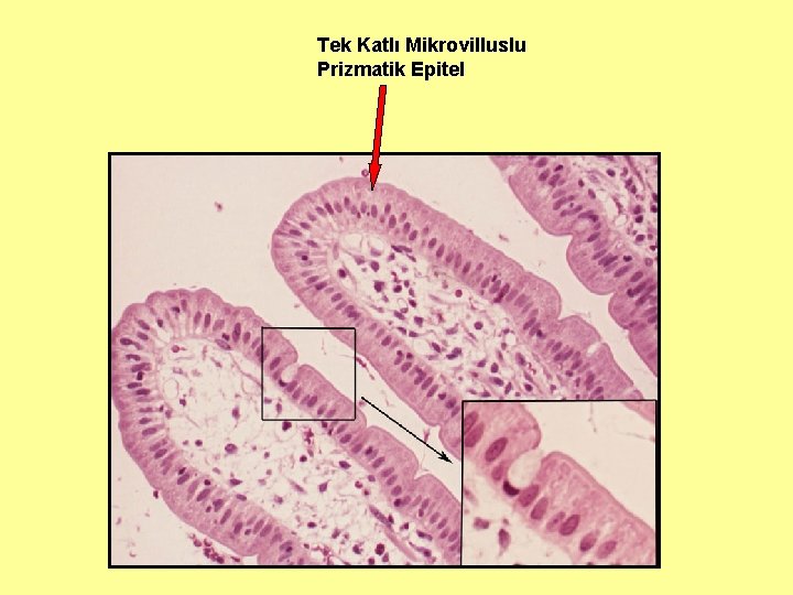 Tek Katlı Mikrovilluslu Prizmatik Epitel 