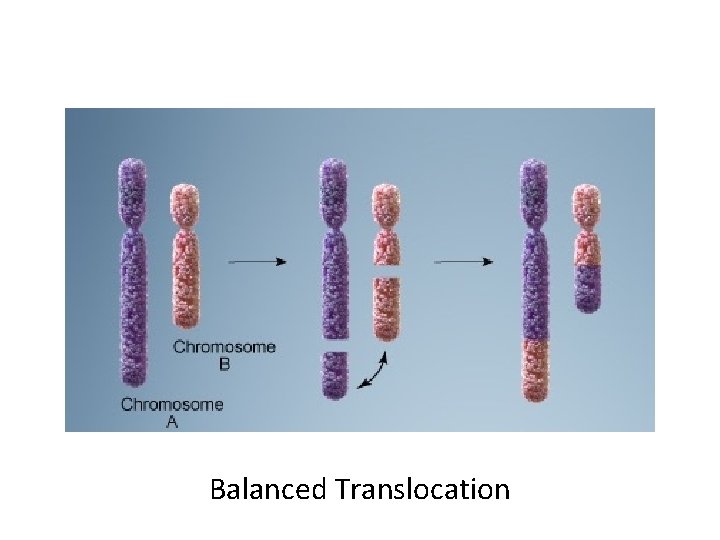 Balanced Translocation 