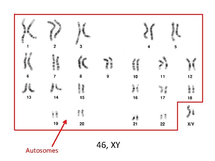 Autosomes 46, XY 