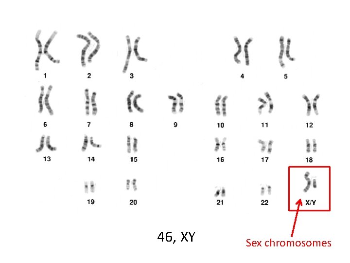 46, XY Sex chromosomes 