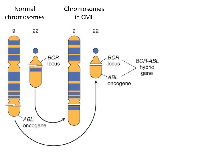 Normal chromosomes Chromosomes in CML 