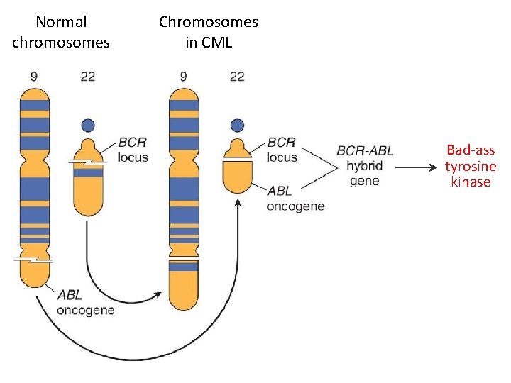 Normal chromosomes Chromosomes in CML Bad-ass tyrosine kinase 