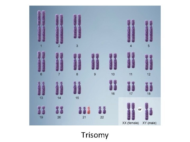 Trisomy 