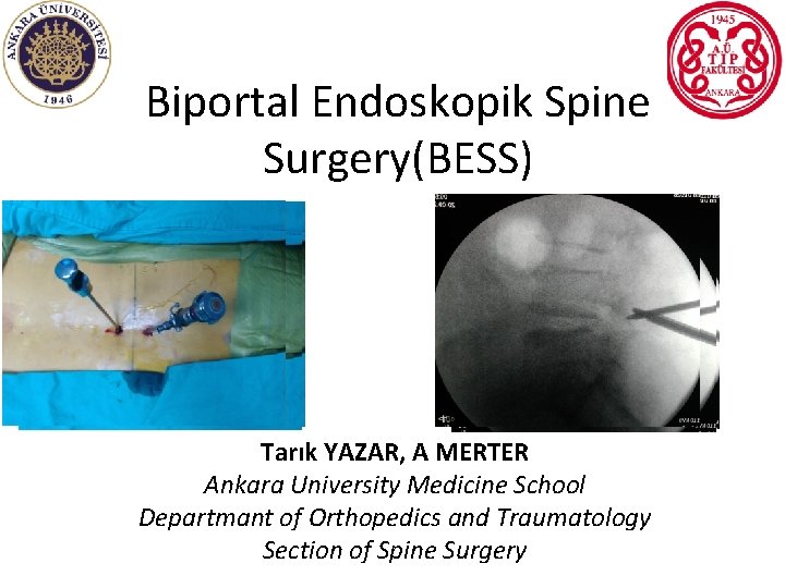 Biportal Endoskopik Spine Surgery(BESS) Tarık YAZAR, A MERTER Ankara University Medicine School Departmant of