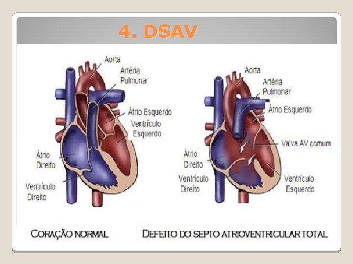 4. DSAV 