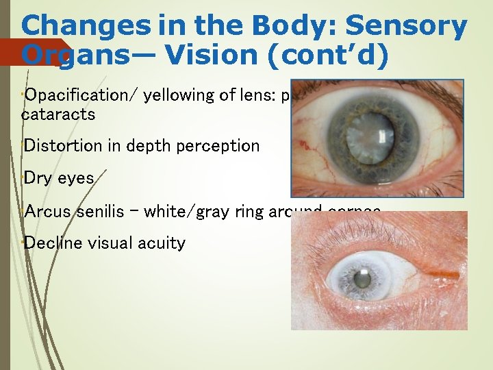 Changes in the Body: Sensory Organs— Vision (cont’d) • Opacification/ yellowing of lens: potential