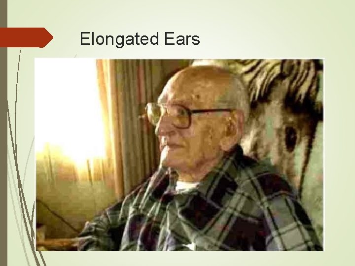 Elongated Ears 