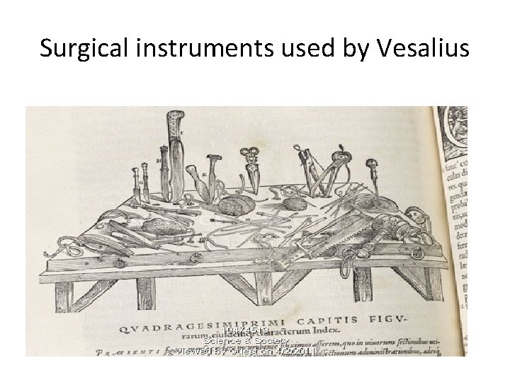 Surgical instruments used by Vesalius 