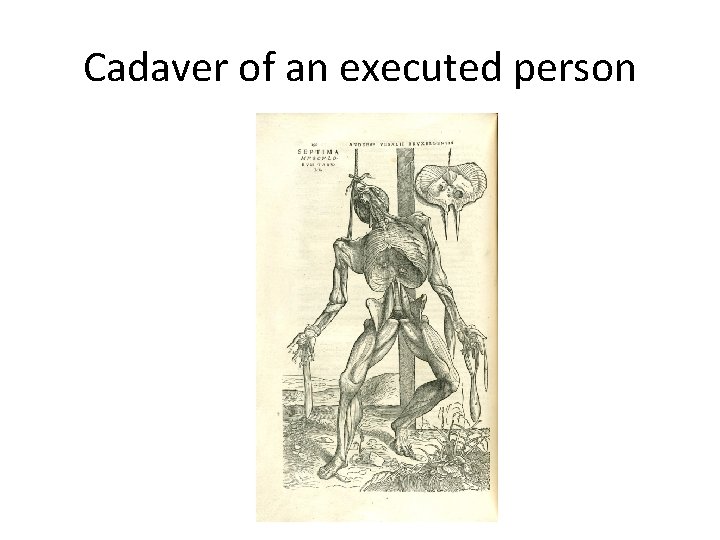 Cadaver of an executed person 