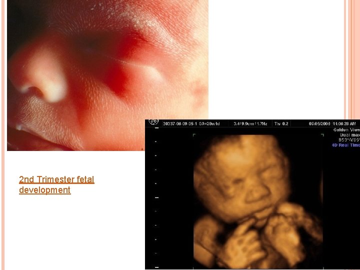 2 nd Trimester fetal development 