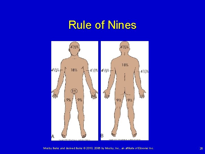 Rule of Nines Mosby items and derived items © 2010, 2006 by Mosby, Inc.