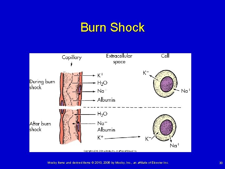 Burn Shock Mosby items and derived items © 2010, 2006 by Mosby, Inc. ,