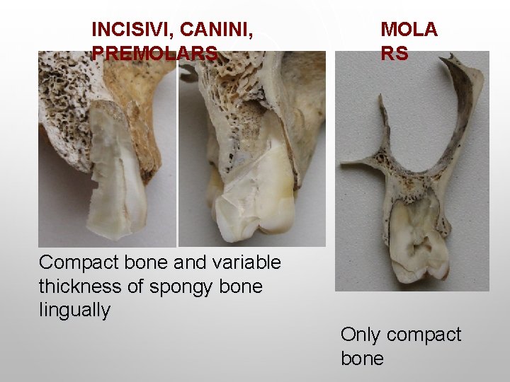 INCISIVI, CANINI, PREMOLARS MOLA RS Compact bone and variable thickness of spongy bone lingually