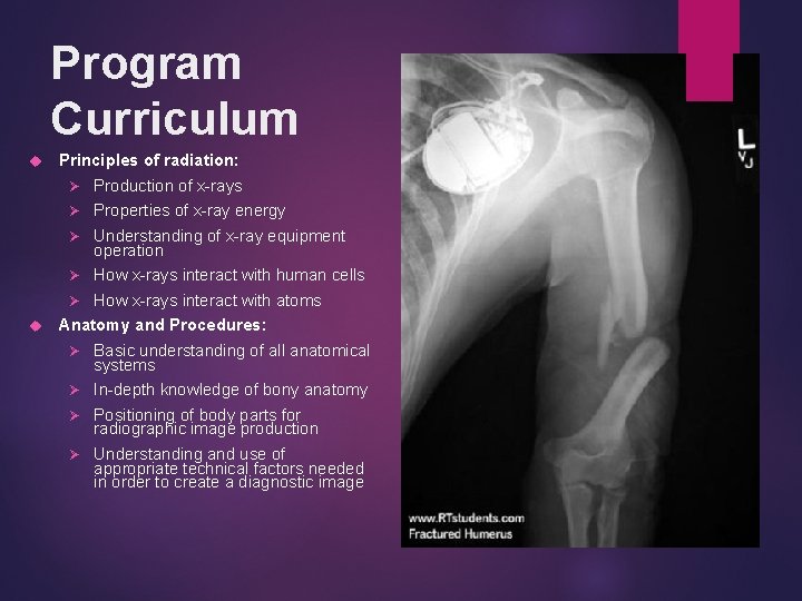 Program Curriculum Principles of radiation: Ø Production of x-rays Ø Properties of x-ray energy