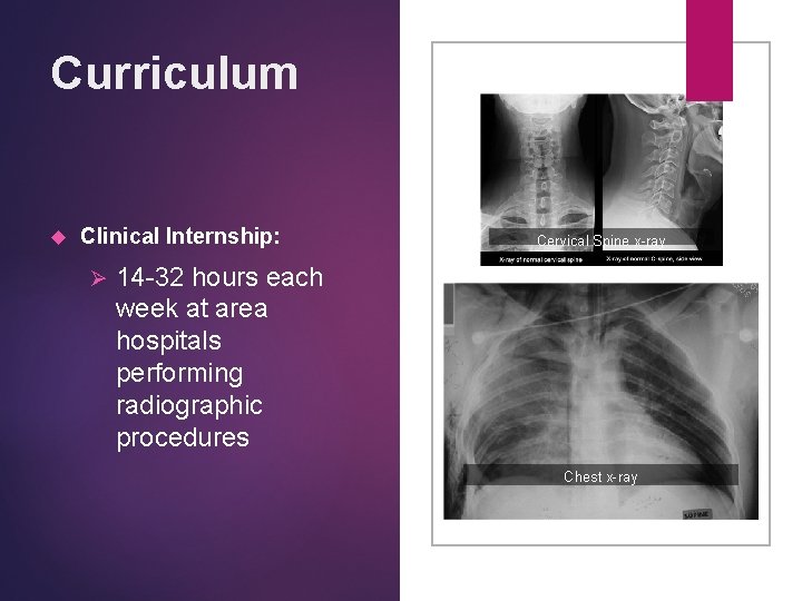 Curriculum Clinical Internship: Ø Cervical Spine x-ray 14 -32 hours each week at area