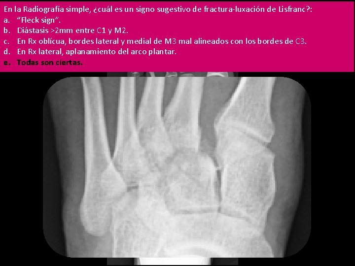 En lala. Radiografía un de fractura-luxación de Ante En estos Radiografía datossimple, clínicos simple,