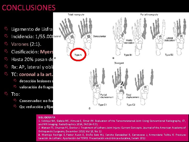 CONCLUSIONES õ õ õ õ Ligamento de Lisfranc (C 1 -M 2): soporte más