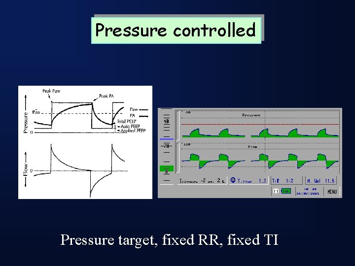Pressure controlled Pressure target, fixed RR, fixed TI 