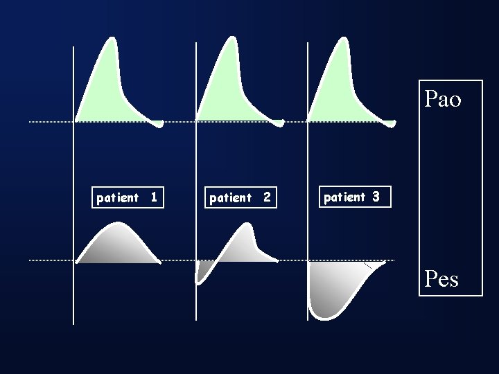 Pao patient 1 patient 2 patient 3 Pes 