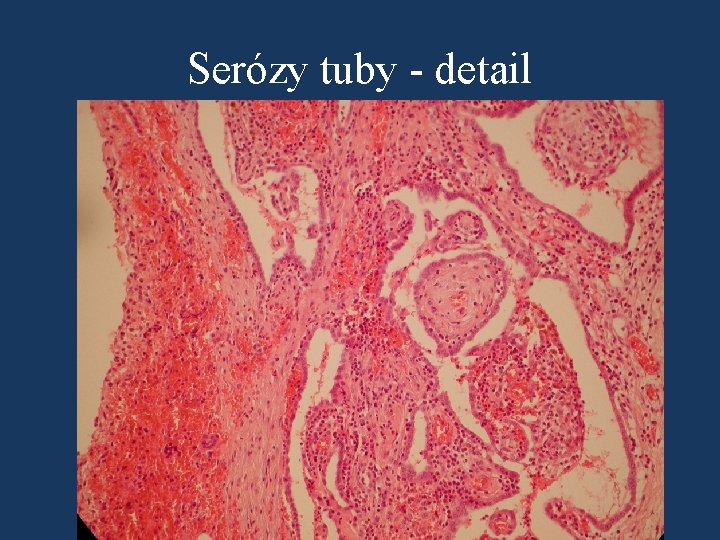 Serózy tuby - detail 