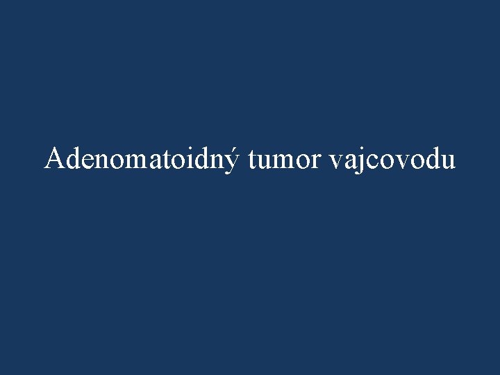 Adenomatoidný tumor vajcovodu 