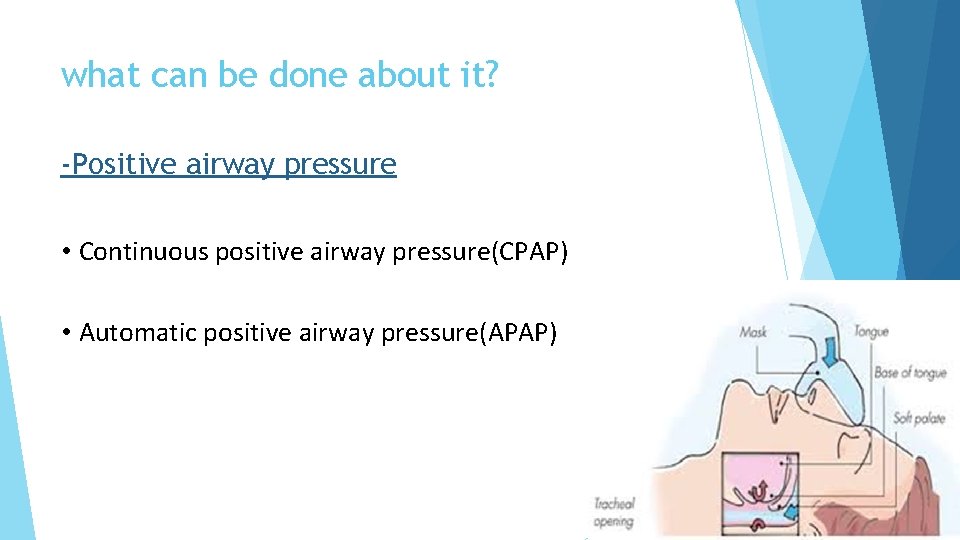 what can be done about it? -Positive airway pressure • Continuous positive airway pressure(CPAP)