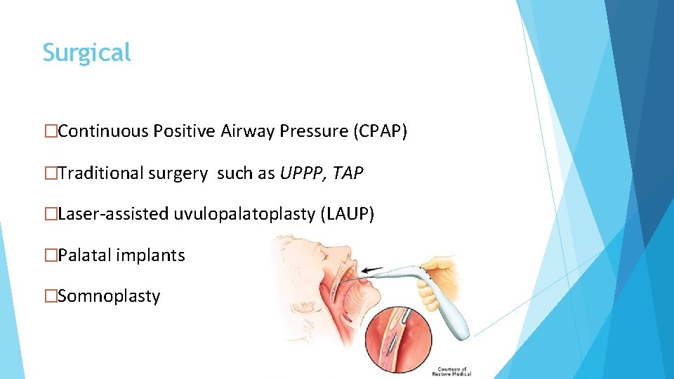 Surgical �Continuous Positive Airway Pressure (CPAP) �Traditional surgery such as UPPP, TAP �Laser-assisted uvulopalatoplasty