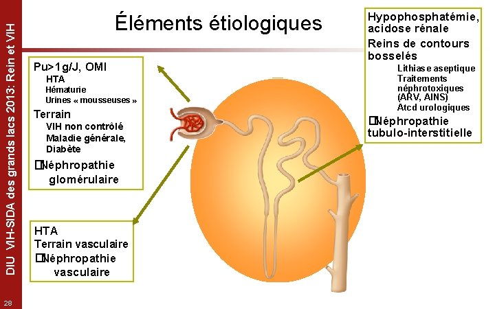 DIU VIH-SIDA des grands lacs 2013: Rein et VIH 28 Éléments étiologiques Pu>1 g/J,